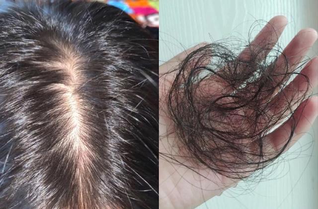 頭油女生多有這幾個(gè)壞習(xí)慣，看看你踩中了幾個(gè)？現(xiàn)在改正還不遲